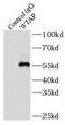 WT1 Associated Protein antibody, FNab09529, FineTest, Immunoprecipitation image 