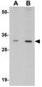 Mesenchyme Homeobox 1 antibody, GTX84998, GeneTex, Western Blot image 