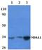 CD20 antibody, GTX66791, GeneTex, Western Blot image 