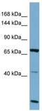OCA2 Melanosomal Transmembrane Protein antibody, TA334666, Origene, Western Blot image 