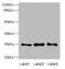 Ras-related protein Rab-3B antibody, A63262-100, Epigentek, Western Blot image 