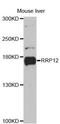 Regulation Of Nuclear Pre-MRNA Domain Containing 2 antibody, LS-C748139, Lifespan Biosciences, Western Blot image 