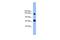Pleckstrin Homology And RhoGEF Domain Containing G2 antibody, A09521, Boster Biological Technology, Western Blot image 