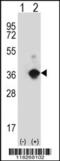 Angiopoietin-related protein 7 antibody, 62-309, ProSci, Western Blot image 