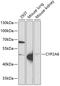 Cytochrome P450 Family 2 Subfamily A Member 6 antibody, GTX53968, GeneTex, Western Blot image 