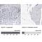 DEAD-Box Helicase 56 antibody, NBP1-83310, Novus Biologicals, Immunohistochemistry paraffin image 