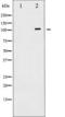 Platelet Derived Growth Factor Receptor Beta antibody, TA325769, Origene, Western Blot image 