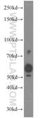 SPO11 Initiator Of Meiotic Double Stranded Breaks antibody, 15509-1-AP, Proteintech Group, Western Blot image 