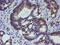 ETS domain-containing protein Elk-3 antibody, M06026, Boster Biological Technology, Immunohistochemistry paraffin image 