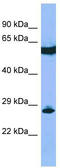 Guanylyl Cyclase Domain Containing 1 antibody, TA333630, Origene, Western Blot image 