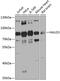 HAUS Augmin Like Complex Subunit 3 antibody, 23-480, ProSci, Western Blot image 