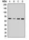 Excitatory amino acid transporter 2 antibody, LS-C667794, Lifespan Biosciences, Western Blot image 