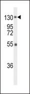 Fibroblast Growth Factor Receptor 1 antibody, LS-C166142, Lifespan Biosciences, Western Blot image 