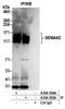 Semaphorin 4D antibody, A304-394A, Bethyl Labs, Immunoprecipitation image 