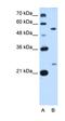 Phosphatidate cytidylyltransferase 1 antibody, orb325205, Biorbyt, Western Blot image 