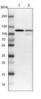 Ubiquitin Specific Peptidase 5 antibody, NBP1-83089, Novus Biologicals, Western Blot image 