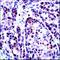 Telomerase Reverse Transcriptase antibody, TA354468, Origene, Immunohistochemistry paraffin image 