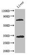 Histone deacetylase 10 antibody, orb45890, Biorbyt, Western Blot image 