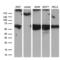 Centrosomal Protein 63 antibody, LS-C794823, Lifespan Biosciences, Western Blot image 