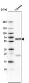 Serpin Family A Member 3 antibody, HPA002560, Atlas Antibodies, Western Blot image 