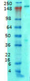 Ankyrin-2 antibody, TA326443, Origene, Western Blot image 
