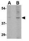 Solute Carrier Family 35 Member D1 antibody, GTX85399, GeneTex, Western Blot image 