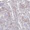 Slingshot Protein Phosphatase 2 antibody, NBP2-49245, Novus Biologicals, Immunohistochemistry paraffin image 