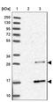 RAB, Member Of RAS Oncogene Family Like 2A antibody, NBP2-46696, Novus Biologicals, Western Blot image 