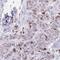 Adenylate Kinase 9 antibody, HPA036324, Atlas Antibodies, Immunohistochemistry frozen image 