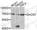7-Dehydrocholesterol Reductase antibody, A8049, ABclonal Technology, Western Blot image 