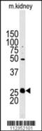 Stanniocalcin 2 antibody, 57-734, ProSci, Western Blot image 