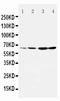 Dopamine Receptor D1 antibody, PA1571, Boster Biological Technology, Western Blot image 