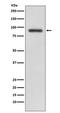 RalA Binding Protein 1 antibody, M01403, Boster Biological Technology, Western Blot image 