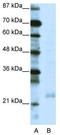 TATA-Box Binding Protein Associated Factor 10 antibody, TA329277, Origene, Western Blot image 