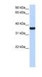 Tumor Protein P53 Inducible Protein 13 antibody, NBP1-79465, Novus Biologicals, Western Blot image 