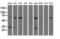 Pyrroline-5-Carboxylate Reductase 2 antibody, GTX83754, GeneTex, Western Blot image 