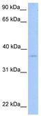 NIPA Like Domain Containing 2 antibody, TA338675, Origene, Western Blot image 