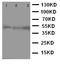 C-C Motif Chemokine Receptor 9 antibody, LS-C313244, Lifespan Biosciences, Western Blot image 