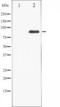 Src substrate cortactin antibody, TA325399, Origene, Western Blot image 