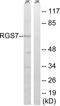 Regulator Of G Protein Signaling 7 antibody, A04305, Boster Biological Technology, Western Blot image 