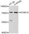 Potassium channel subfamily K member 10 antibody, abx126038, Abbexa, Western Blot image 