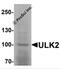 Unc-51 Like Autophagy Activating Kinase 2 antibody, 7337, ProSci, Western Blot image 