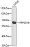 Protein Phosphatase 2 Scaffold Subunit Abeta antibody, GTX65916, GeneTex, Western Blot image 