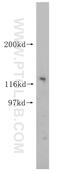 Notch Receptor 1 antibody, 10062-2-AP, Proteintech Group, Western Blot image 
