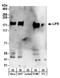 LIF Receptor Subunit Alpha antibody, A304-304A, Bethyl Labs, Western Blot image 