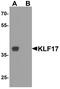 Kruppel Like Factor 17 antibody, PA5-72838, Invitrogen Antibodies, Western Blot image 