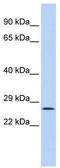 GATA Zinc Finger Domain Containing 1 antibody, TA331798, Origene, Western Blot image 