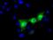 UPF0663 transmembrane protein C17orf28 antibody, GTX84750, GeneTex, Immunocytochemistry image 