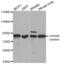 Junction Plakoglobin antibody, AHP2447, Bio-Rad (formerly AbD Serotec) , Western Blot image 