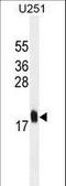 Multiple Coagulation Factor Deficiency 2 antibody, LS-C164085, Lifespan Biosciences, Western Blot image 